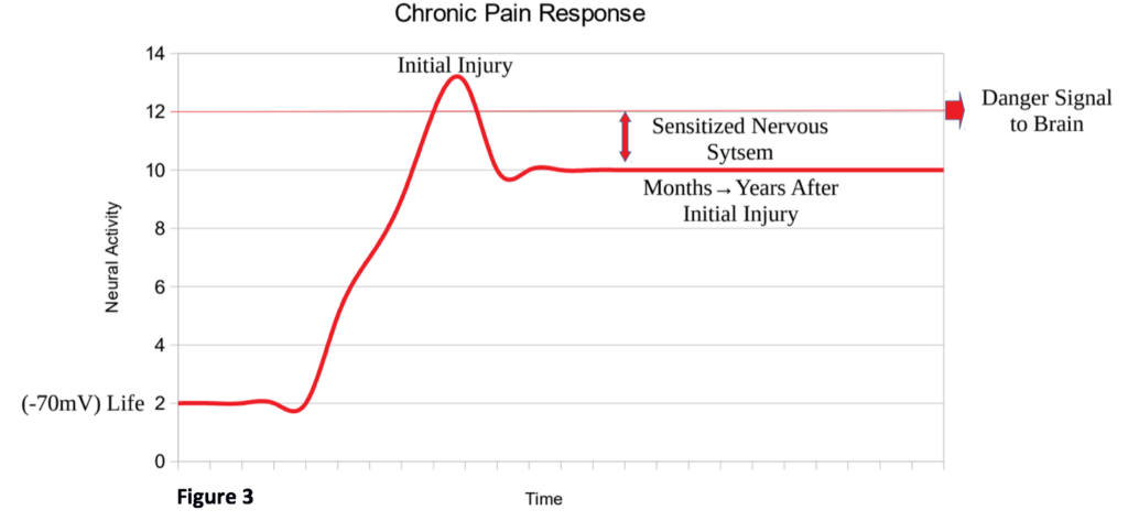Figure Chronic Pain