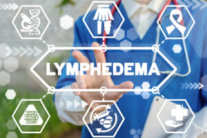 doctor pointing to the word lymphedema surrounded my icons representing medical condition
