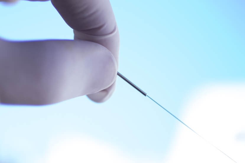a hand holding a needle in front of a blue sky