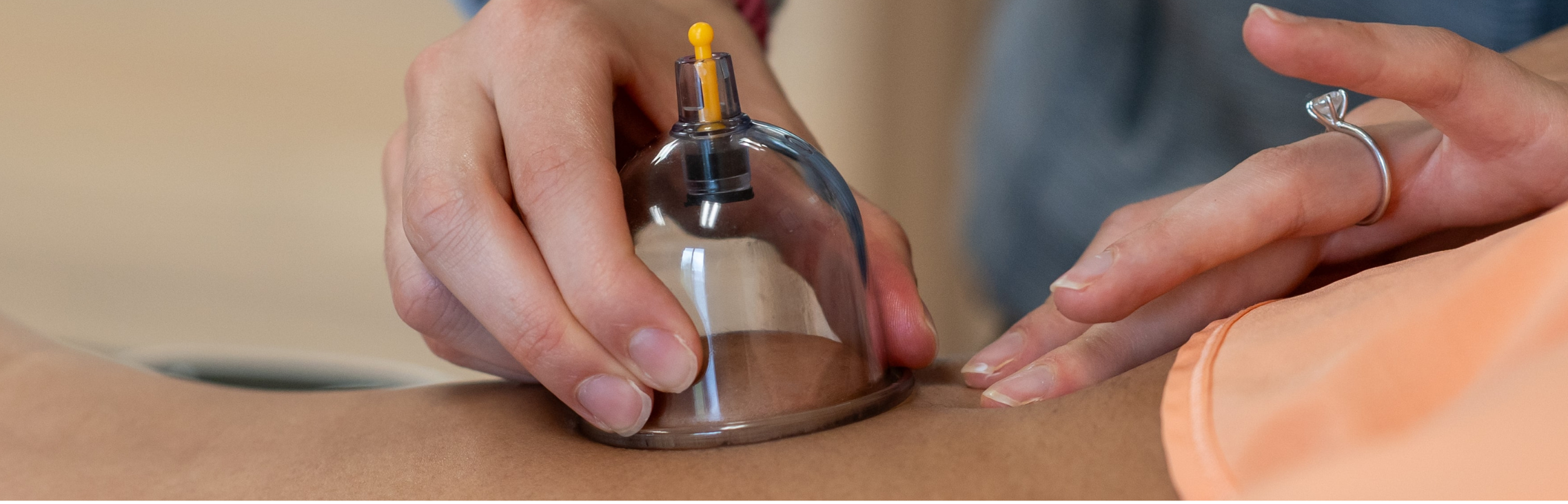 a woman getting a cupping treatment on her leg at Aquacare